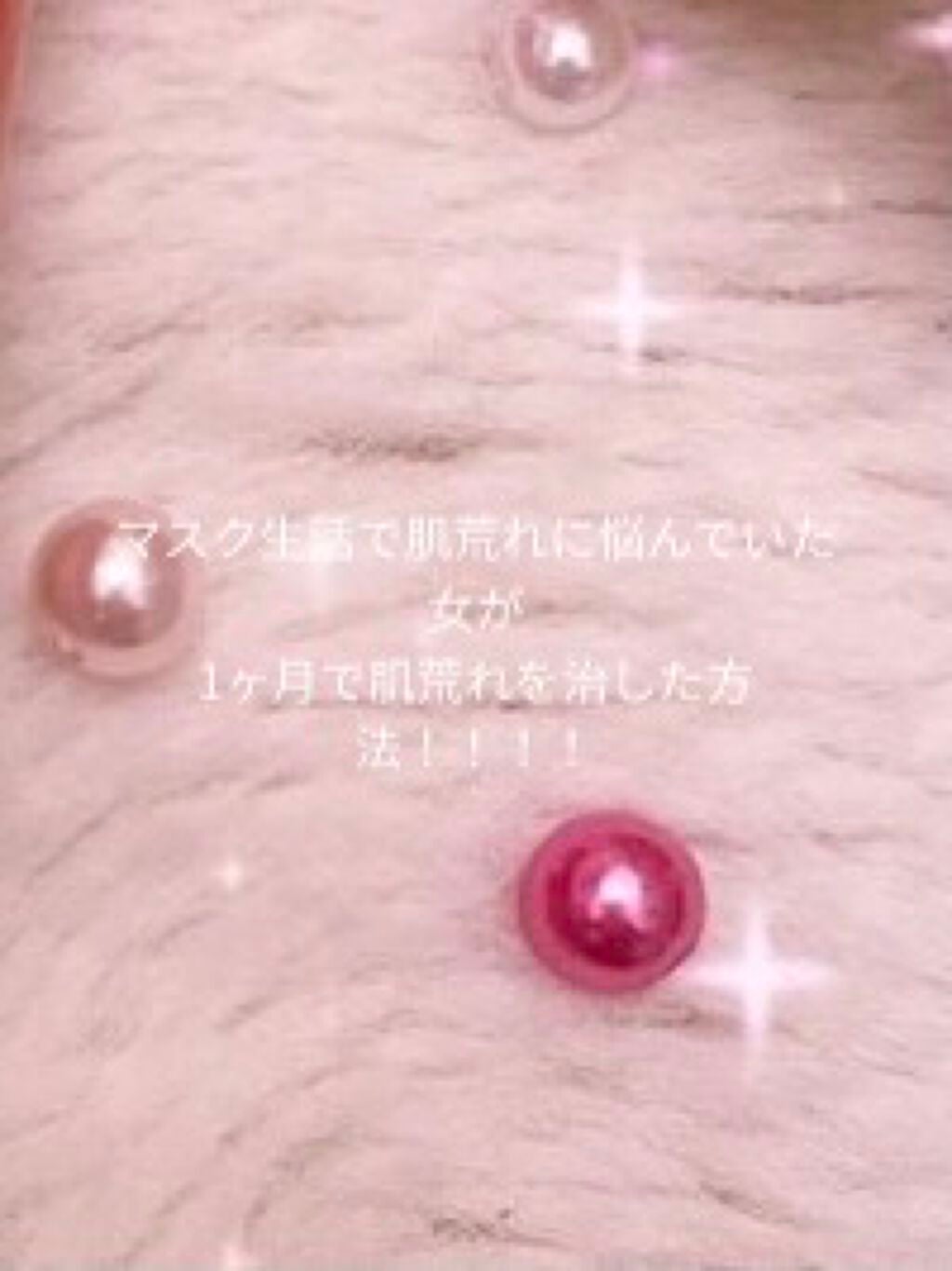 supreme_lips_q2yg on LIPS 「私は2020年の冬ごろからひどい肌荒れに悩んでいました。季節の..」(1枚目)