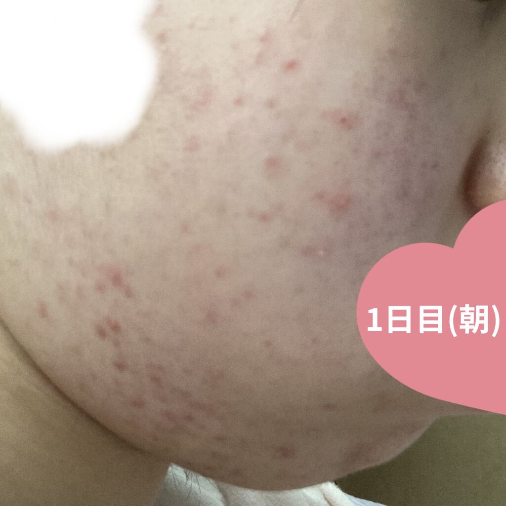 クリアトライアルセット M（しっとりタイプ）/オルビス/トライアルキットを使ったクチコミ（3枚目）