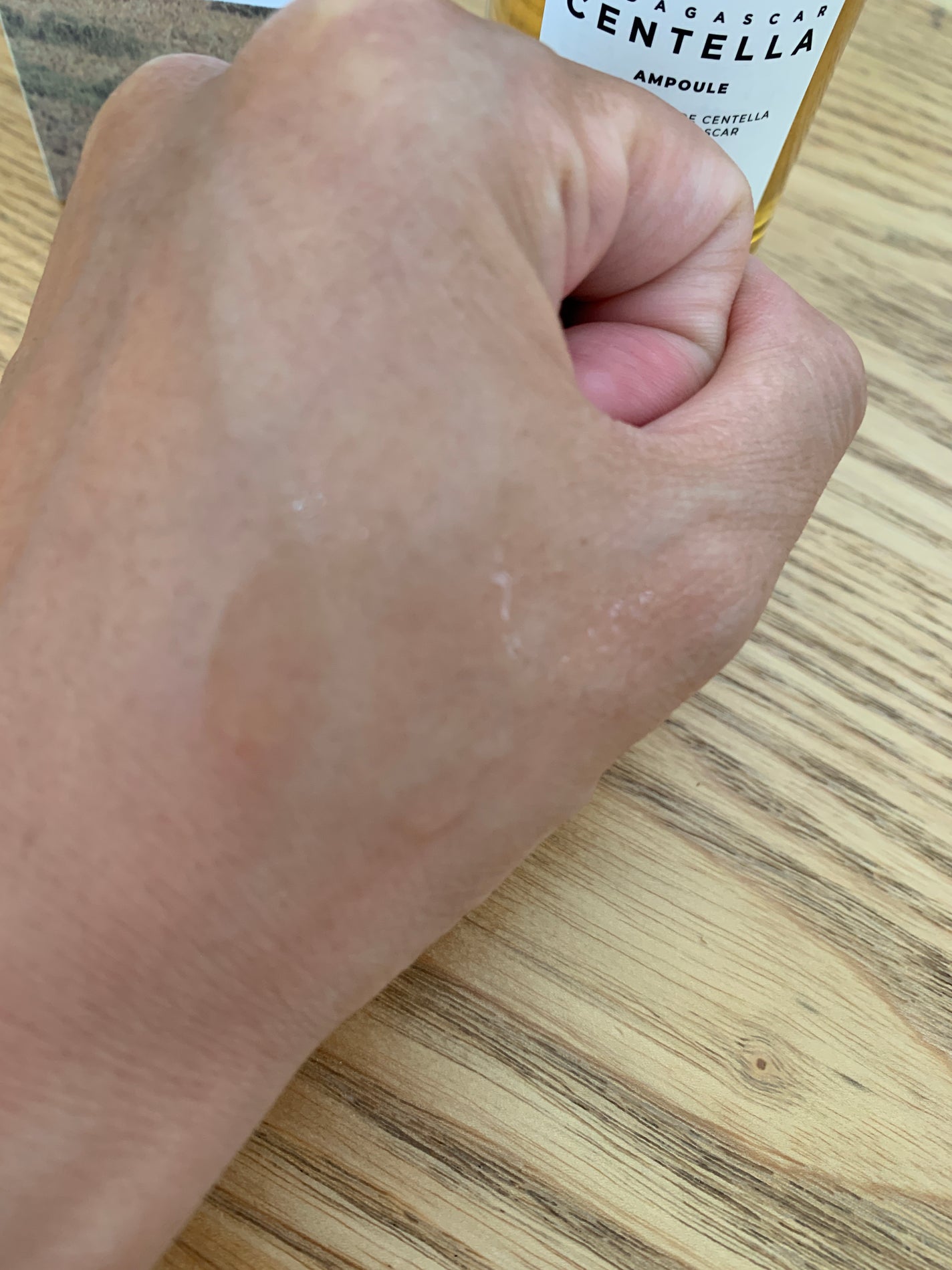 センテラ アンプル/SKIN1004/美容液を使ったクチコミ(2枚目)