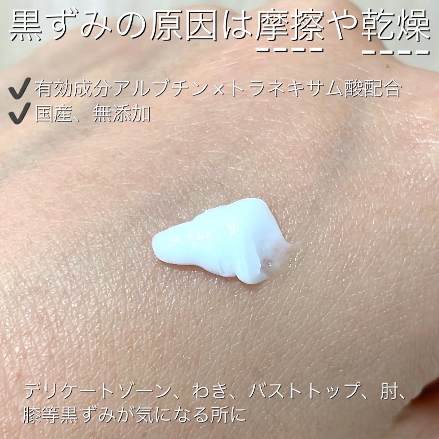 薬用ホワイトケアクリーム/DELIWHITE/デリケートゾーンケアを使ったクチコミ(2枚目)