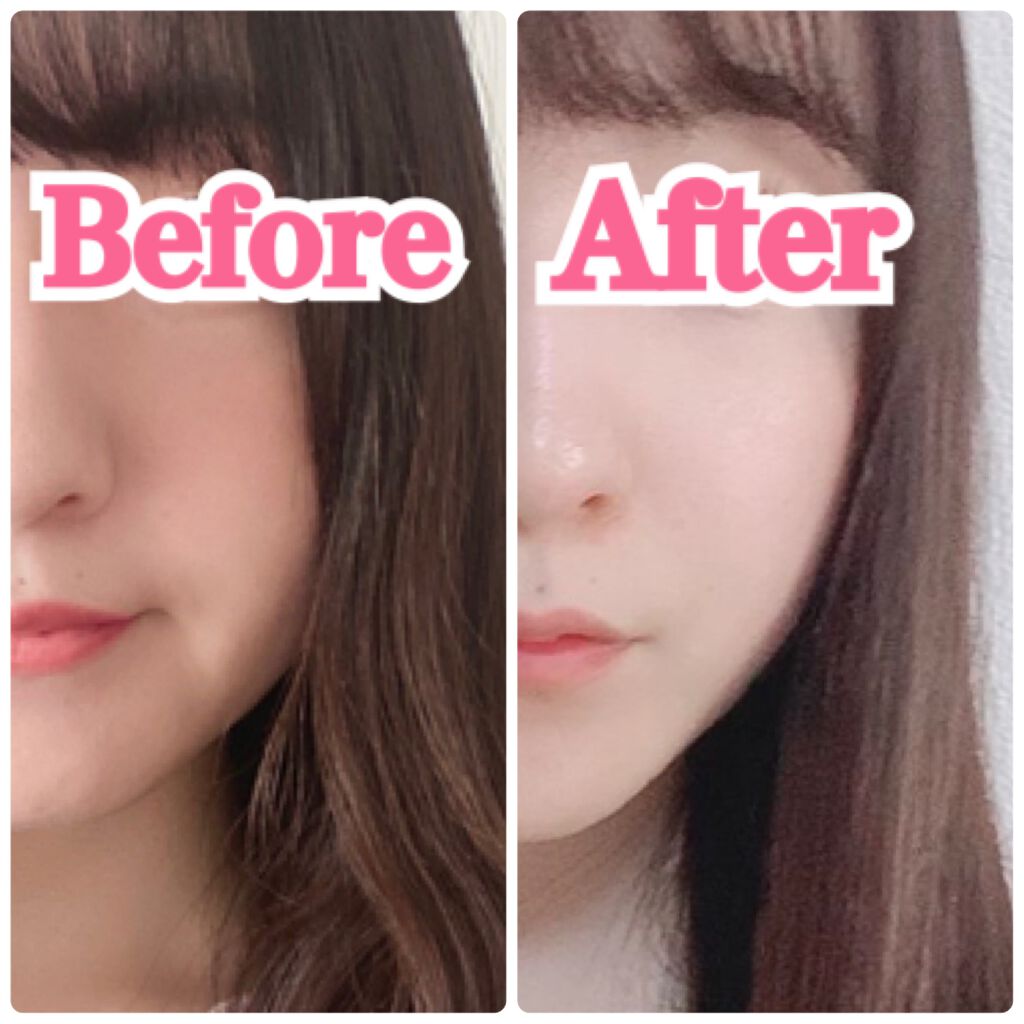 PLUMINUS/mous./美顔器・マッサージを使ったクチコミ(3枚目)