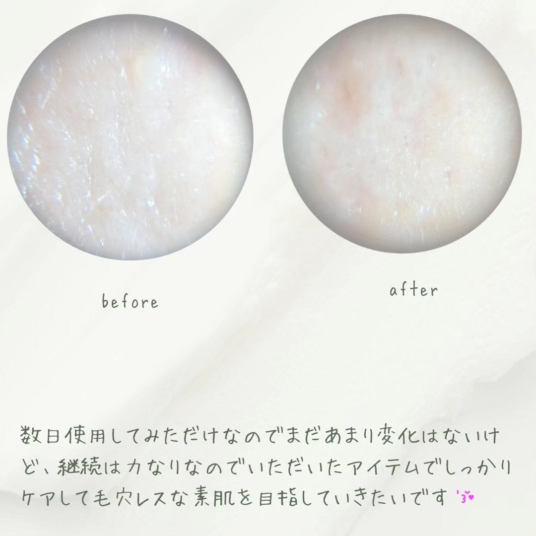 シカレチA エッセンス0.1/VT/美容液を使ったクチコミ(5枚目)