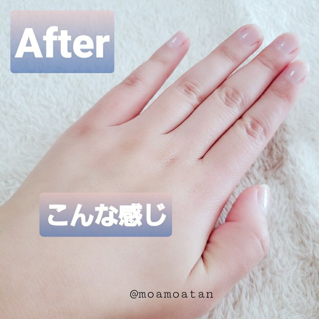 NONON/NONON(ノンノン)/除毛クリームを使ったクチコミ(6枚目)