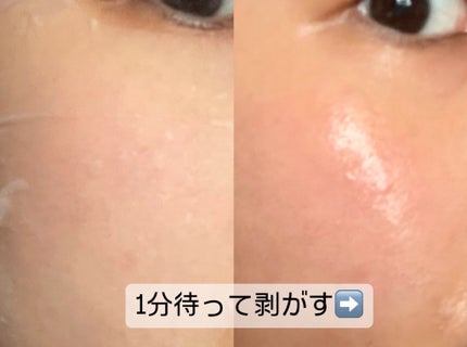 レッドブレミッシュクイックPHAシートマスク/Dr.G/シートマスク・パックを使ったクチコミ(3枚目)