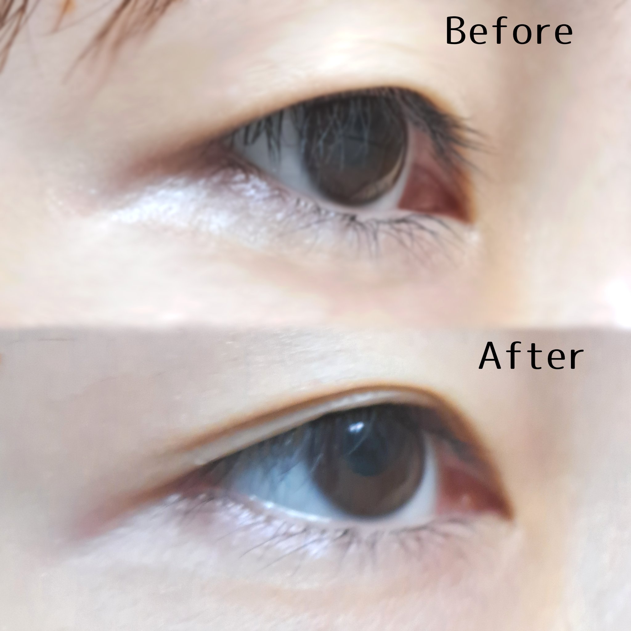 2Wayアイテープ/Eye Catching  Beauty/二重まぶた用アイテムを使ったクチコミ（3枚目）