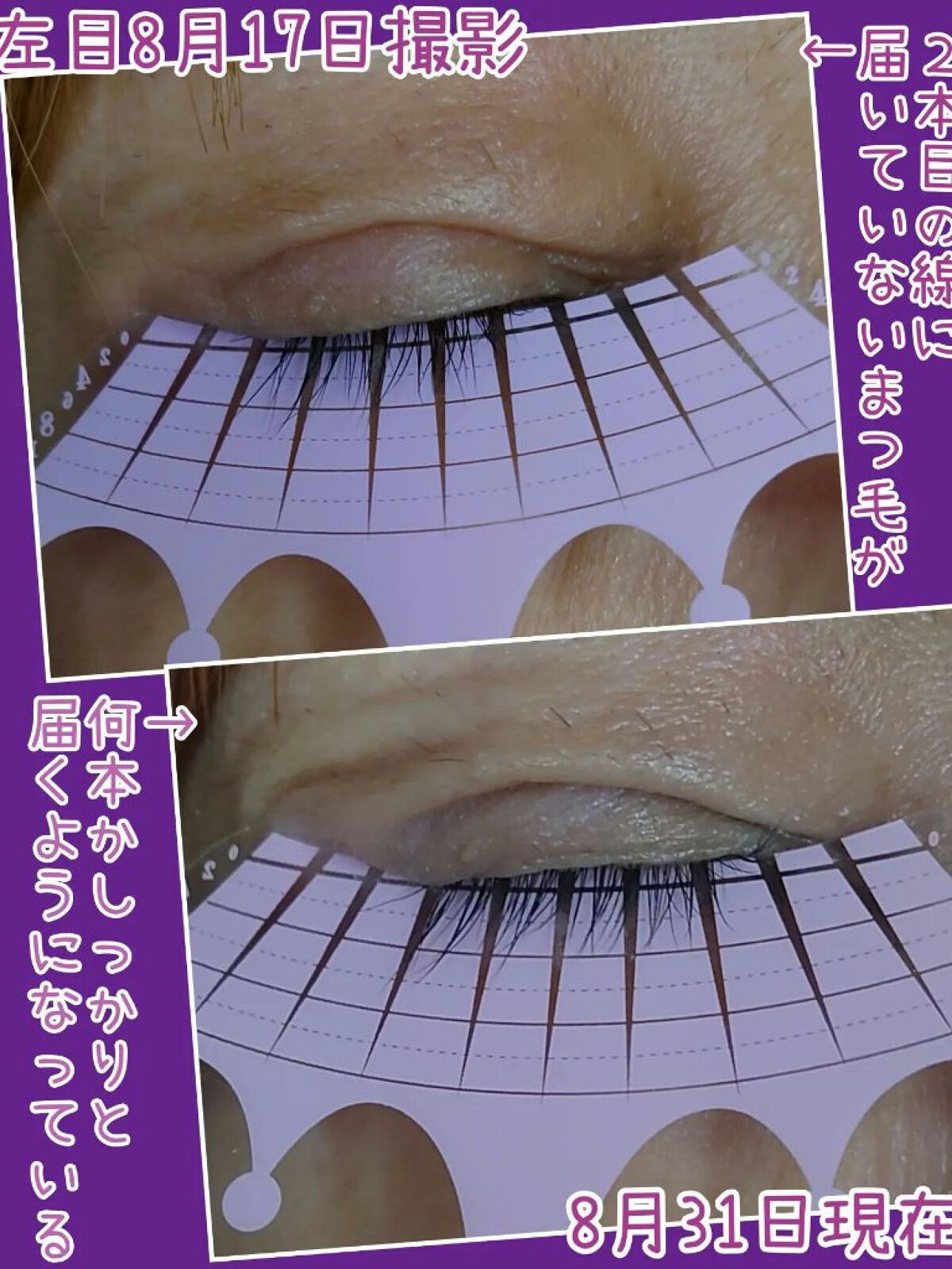 スカルプD ボーテ ピュアフリーアイラッシュセラム　プレミアム/アンファー(スカルプD)/まつげ美容液を使ったクチコミ（2枚目）