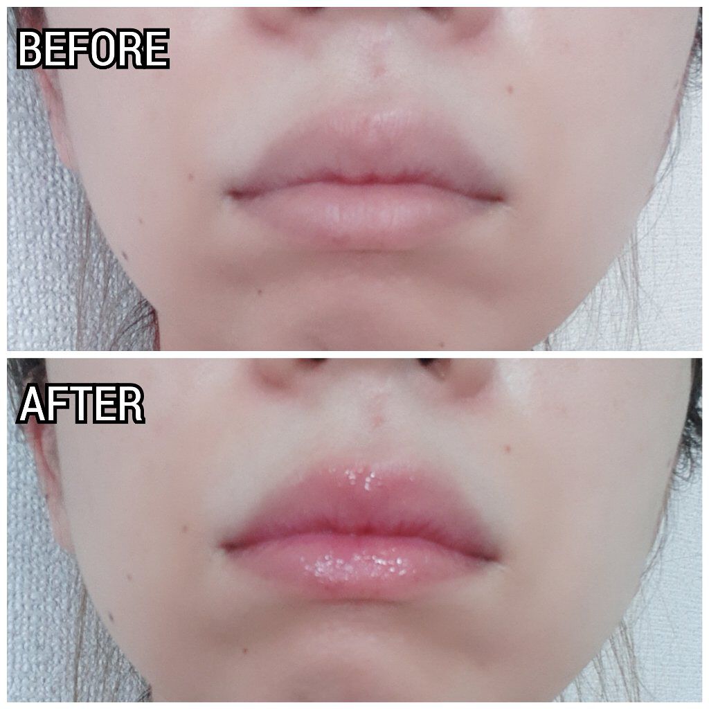 ブルーミングリップグロウ/CAROME./口紅を使ったクチコミ（2枚目）