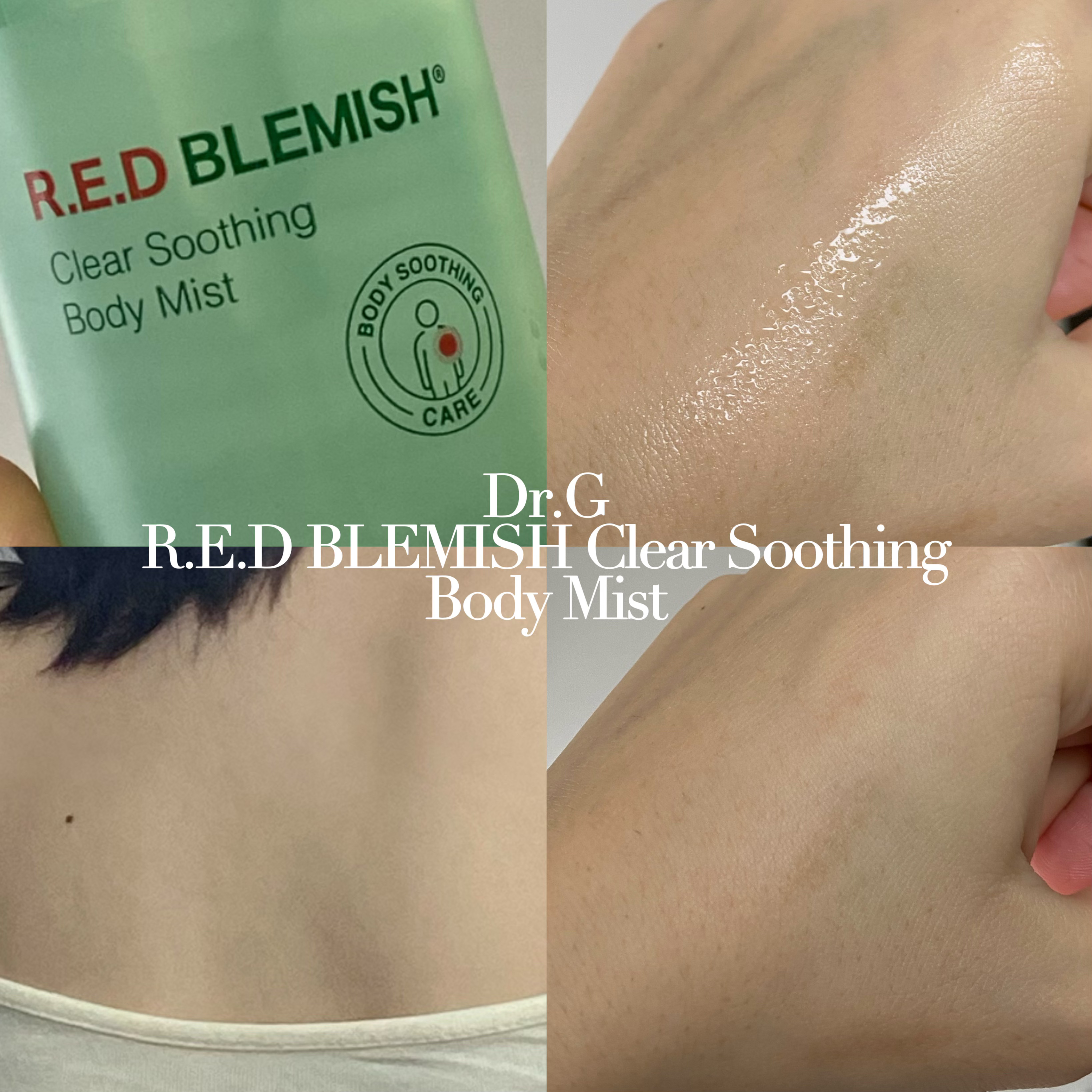 レッドブレミッシュスージングボディウォッシュ/Dr.G/ボディソープを使ったクチコミ（1枚目）