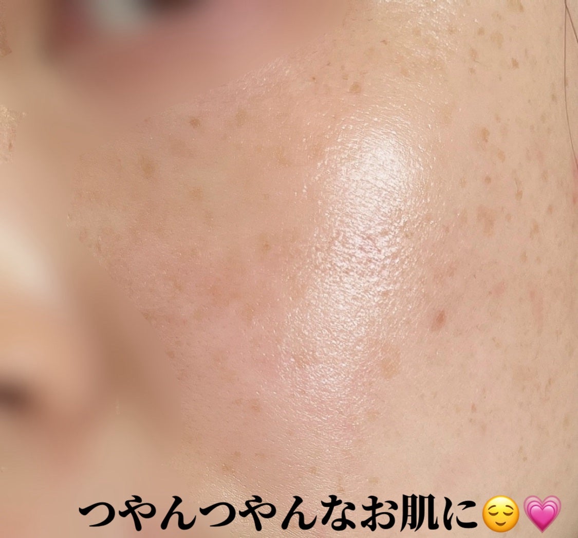 TXトーニングエッセンス1000SHOT/VT/美容液を使ったクチコミ(4枚目)