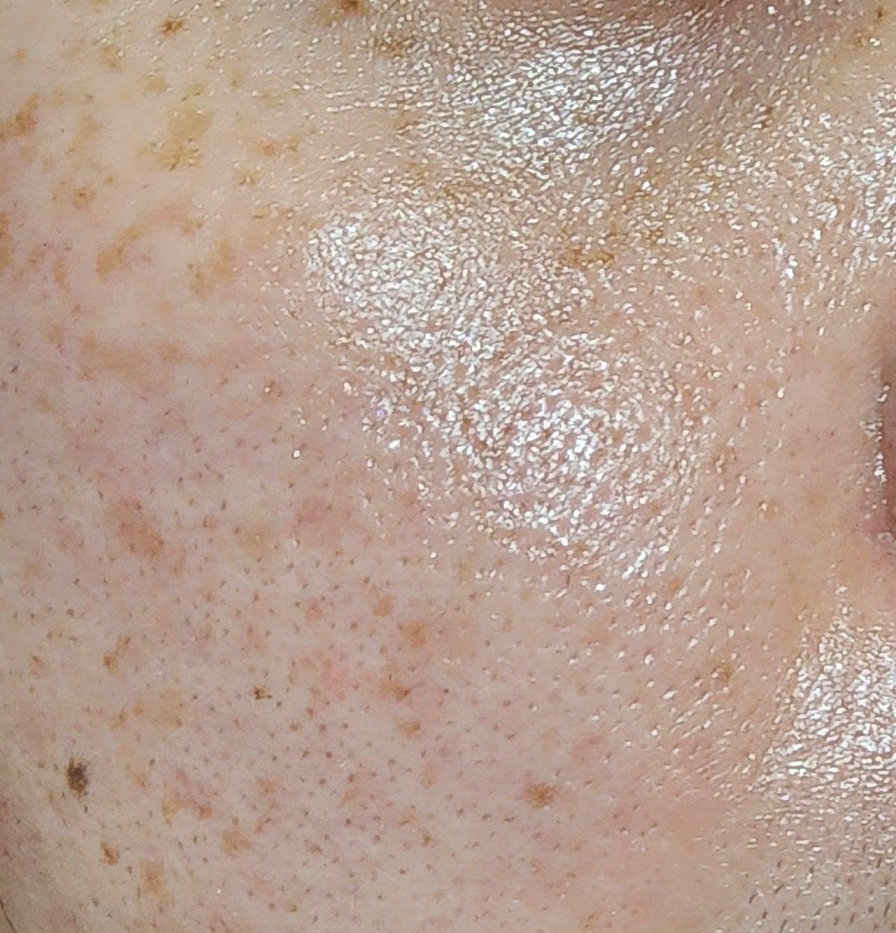 ââððð on LIPS ãèŠãŠðïžTFITã®ããªã±ãŒãã·ã«ã¯ãŽã§ãŒã«ã¢ãŒããã©ã€ããŒäœ¿çš..ãïŒ2æç®ïŒ