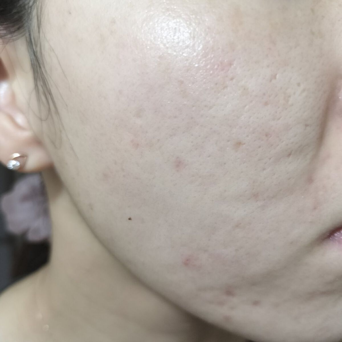 レチノールA 1% アドバンスドリバイタリゼーションクリーム/Life-flo/フェイスクリームを使ったクチコミ（1枚目）