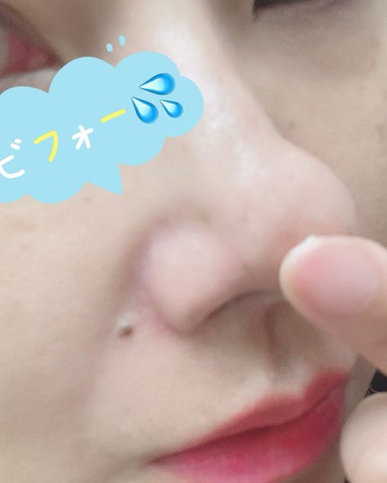 チョコブラ スペシャル毛穴ケアセット/Chocobra/スキンケアキットを使ったクチコミ(4枚目)