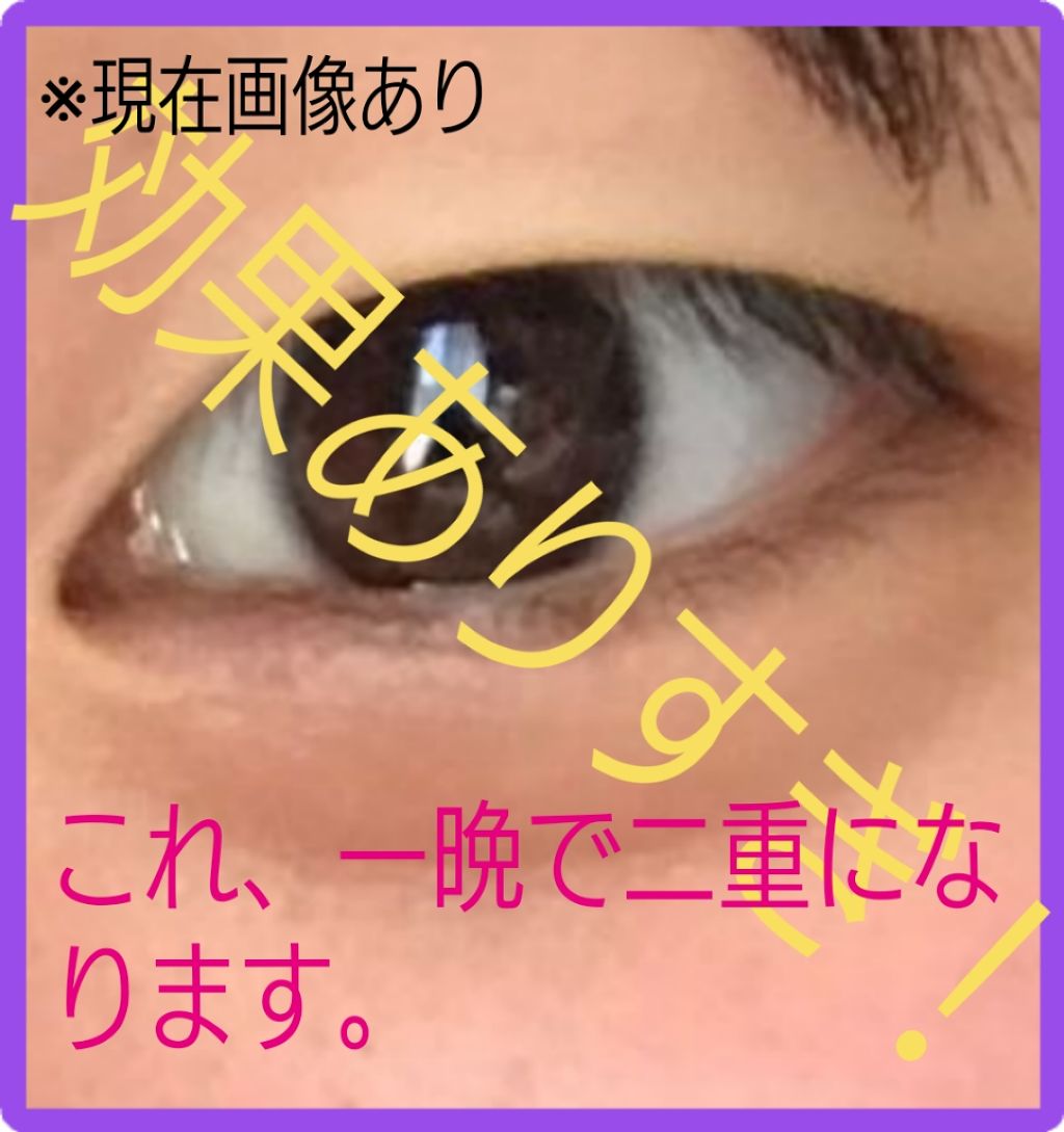 埋没式形成 くっきり二重テープ/DAISO/二重まぶた用アイテムを使ったクチコミ(1枚目)