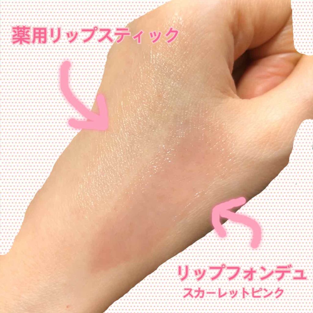 薬用リップスティックXD/メンソレータム/リップクリームを使ったクチコミ（1枚目）