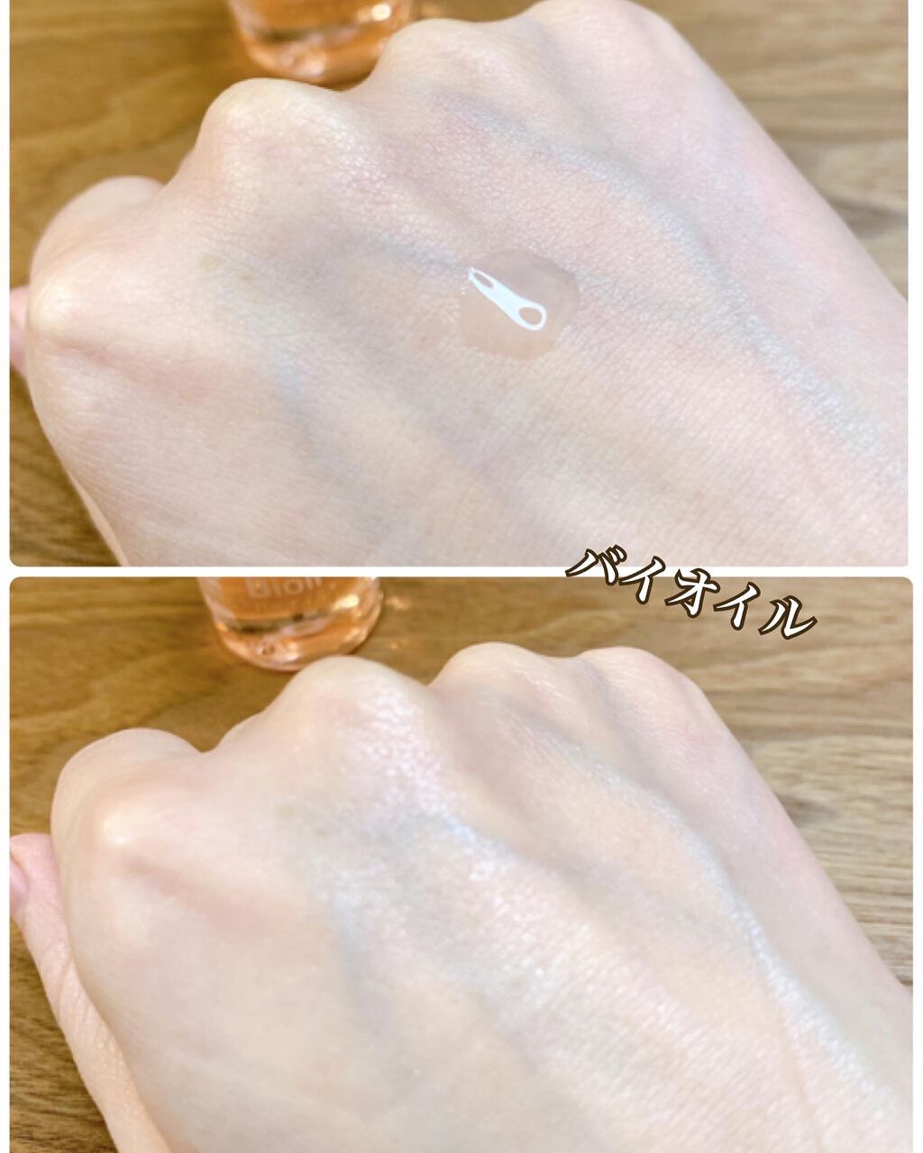 バイオイル/バイオイル/フェイスオイルを使ったクチコミ(4枚目)
