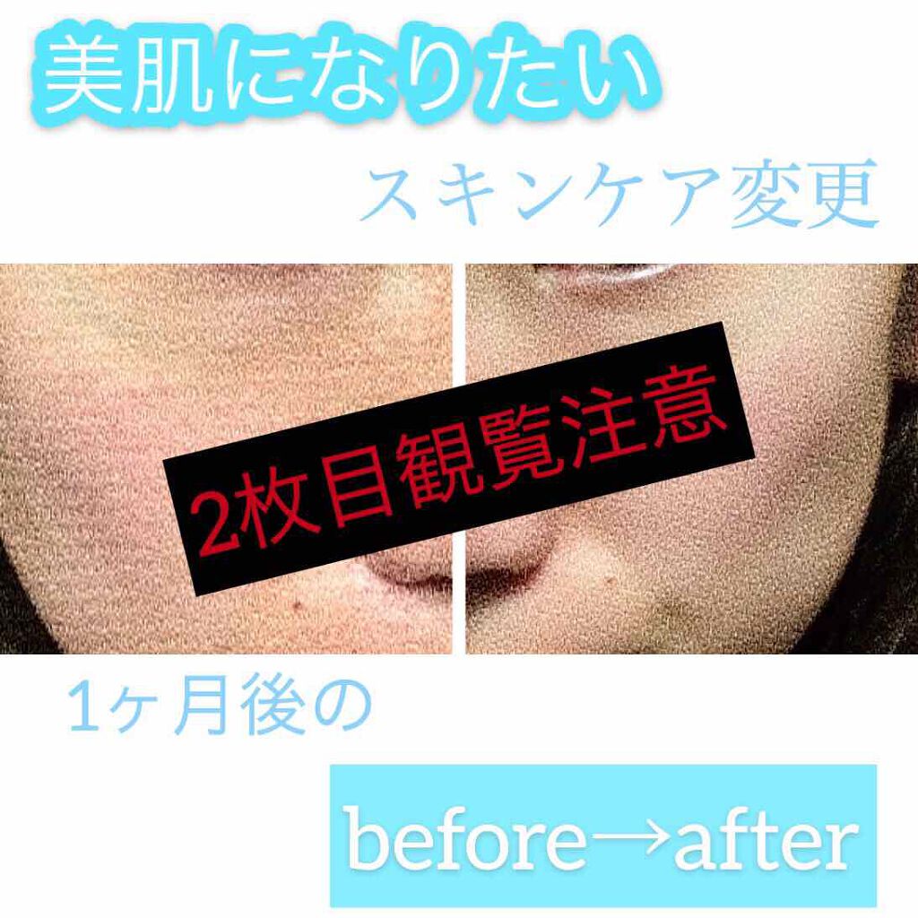 モイストケア エマルジョン R/d プログラム/乳液を使ったクチコミ（1枚目）