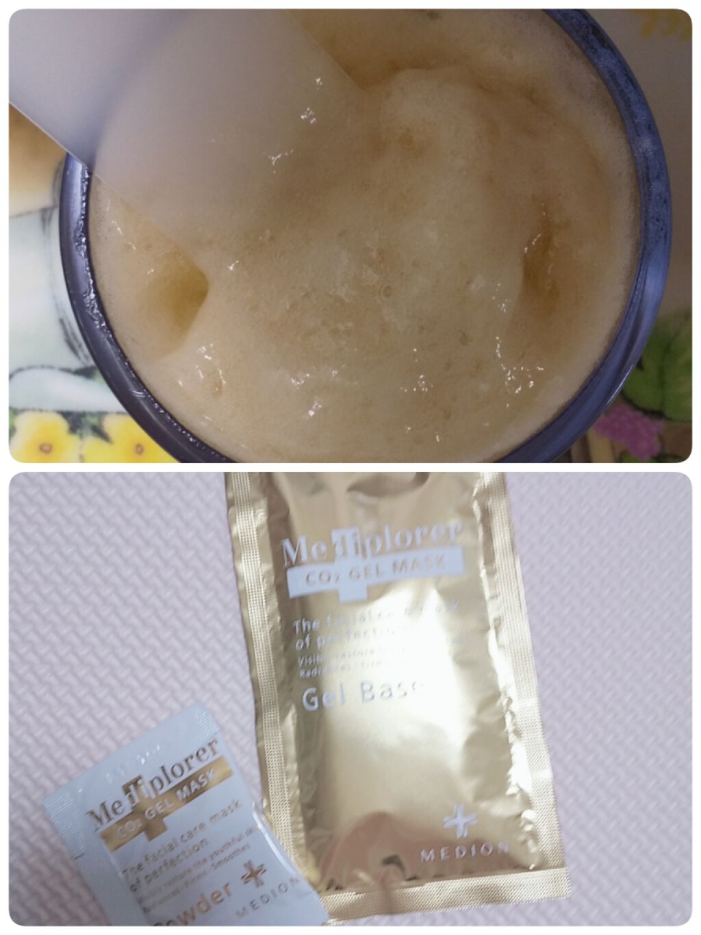 メディプローラー CO2ジェルマスク/ドクターメディオン/洗い流すパック・マスクを使ったクチコミ(2枚目)