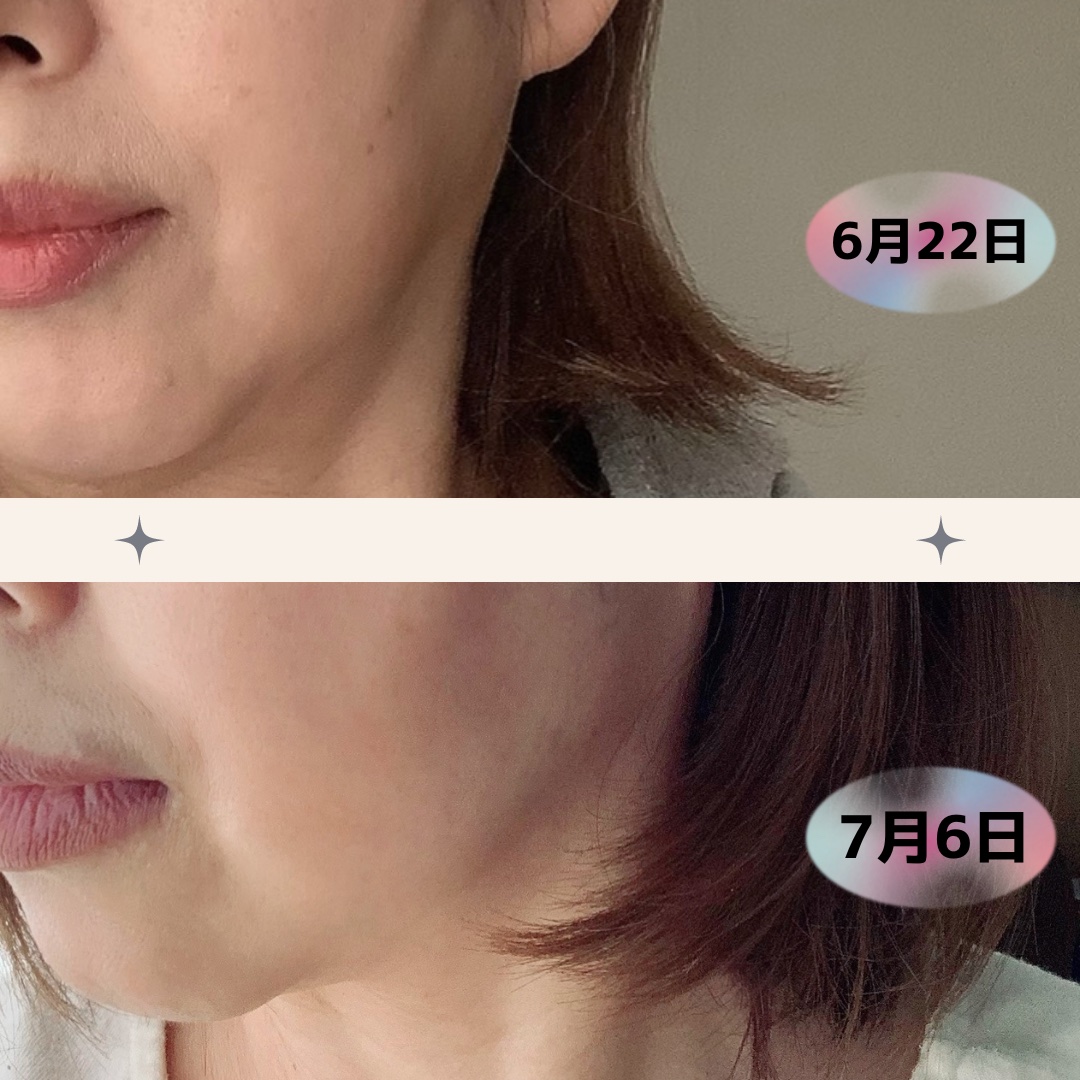 パンテショット675/COSNORI/美容液を使ったクチコミ（2枚目）