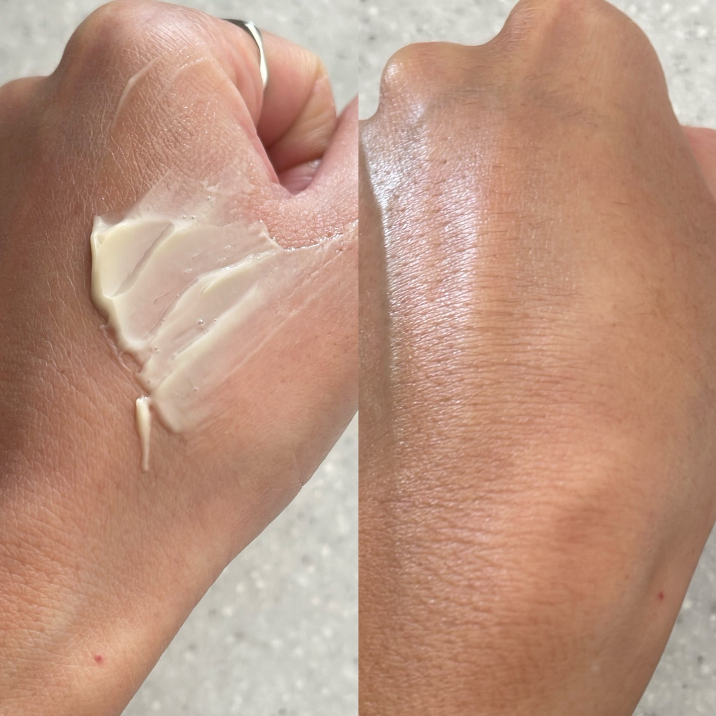 Cemenrete Calcium Intense Cream/Dr.Melaxin/フェイスクリームを使ったクチコミ(3枚目)