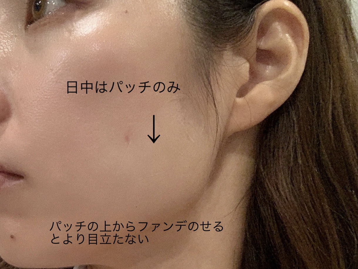 リフターンバンド/リリーイブ/その他化粧小物を使ったクチコミ（3枚目）