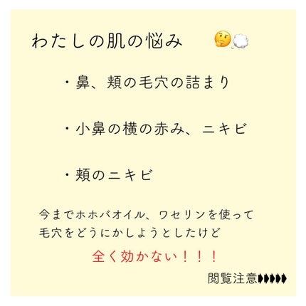 デュオ ザ クレンジングバーム ブラック/DUO/クレンジングバームを使ったクチコミ(2枚目)