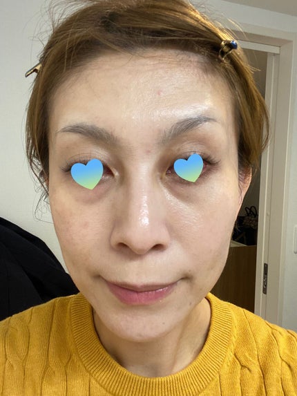 V3シャイニングファンデーション/SPICARE/クッションファンデーションを使ったクチコミ(3枚目)