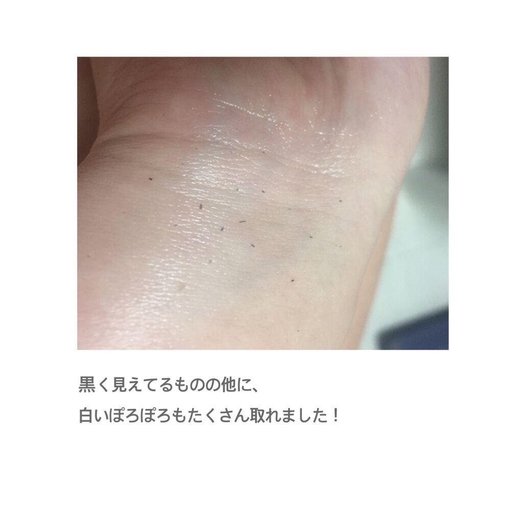 ジョンソン ベビーオイル 無香料/ジョンソンベビー/ボディオイルを使ったクチコミ（3枚目）