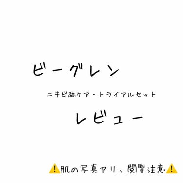 ⚠閲覧注意です⚠
ビーグレンのニキビ跡トライアルセットを10日間ほど使ってみました。
写真は1枚目が使い始めて1日目、2枚目が11日目の写真です。汚い肌ですが、参考までに載せておきました、すみません💦
