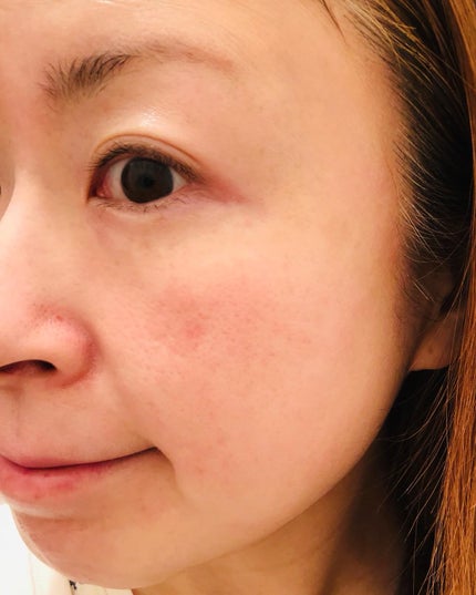 ドクタージー ブラックスネイル コラーゲンミスト/Dr.G/ミスト状化粧水を使ったクチコミ(7枚目)