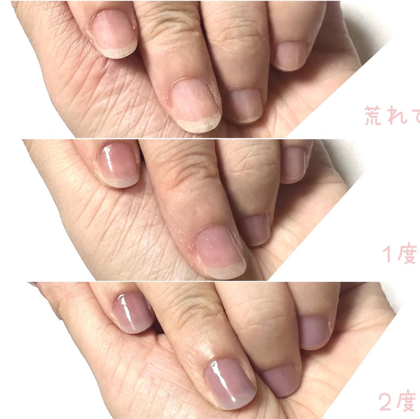 シュガードール オールインワンネイルR/シュガードール/オールインワンネイルを使ったクチコミ(3枚目)