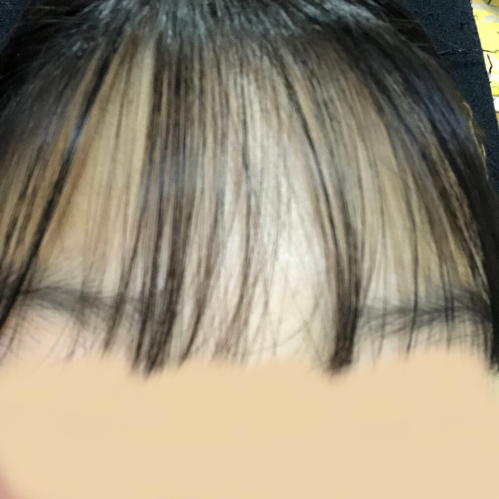 yua on LIPS 「皆さんこんにちは!今回は私の前髪をお見せします!!好評だったら..」(1枚目)