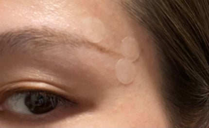 プロCICA クリアスポットパッチ/VT/その他スキンケアを使ったクチコミ(4枚目)