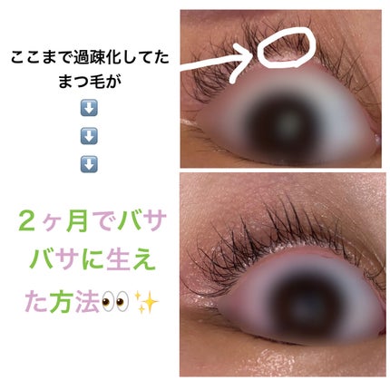 ラッシュアディクト アイラッシュコンディショニングセラム/soaddicted/まつげ美容液を使ったクチコミ(1枚目)