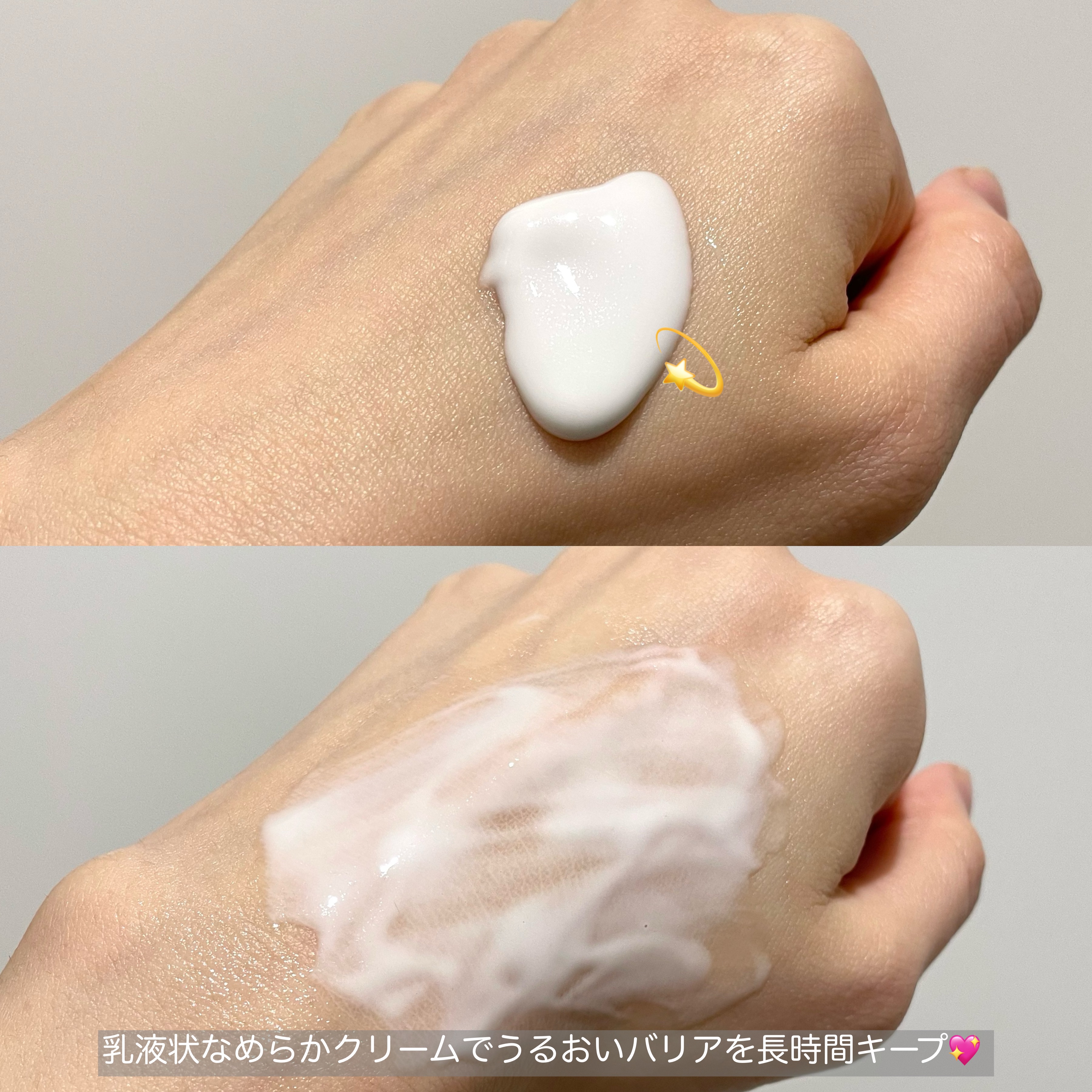 トリクセラNTフルイドクリーム/アベンヌ/ボディクリームを使ったクチコミ（2枚目）