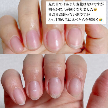 デイケアオイル Dr Nailの口コミ 爪の縦線亀裂で悩んでいる方へ 是非ご覧くだ By R E N A𓂃𓈒𓏸 混合肌 代後半 Lips