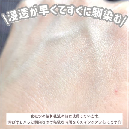 REVERSAL DROP/fonskin/美容液を使ったクチコミ(6枚目)