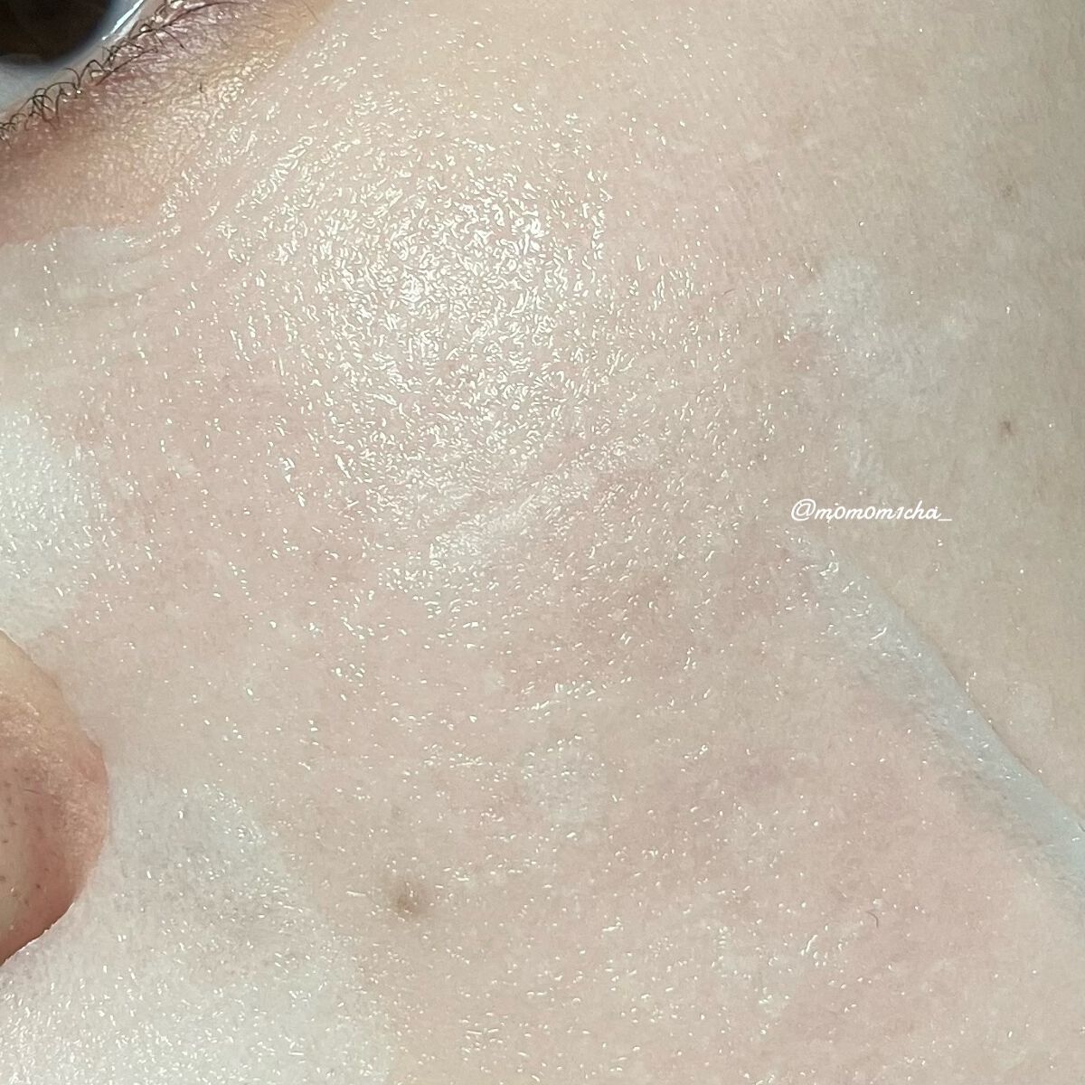 弱酸性pHシートマスク ドクダミフィット/Abib /シートマスク・パックを使ったクチコミ(7枚目)