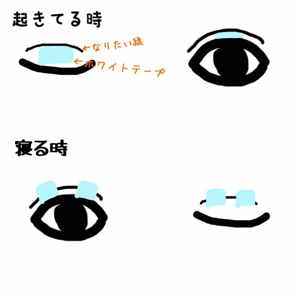 ふたえテープ 目立たず肌になじむ絆創膏タイプ/DAISO/二重まぶた用アイテムを使ったクチコミ(2枚目)