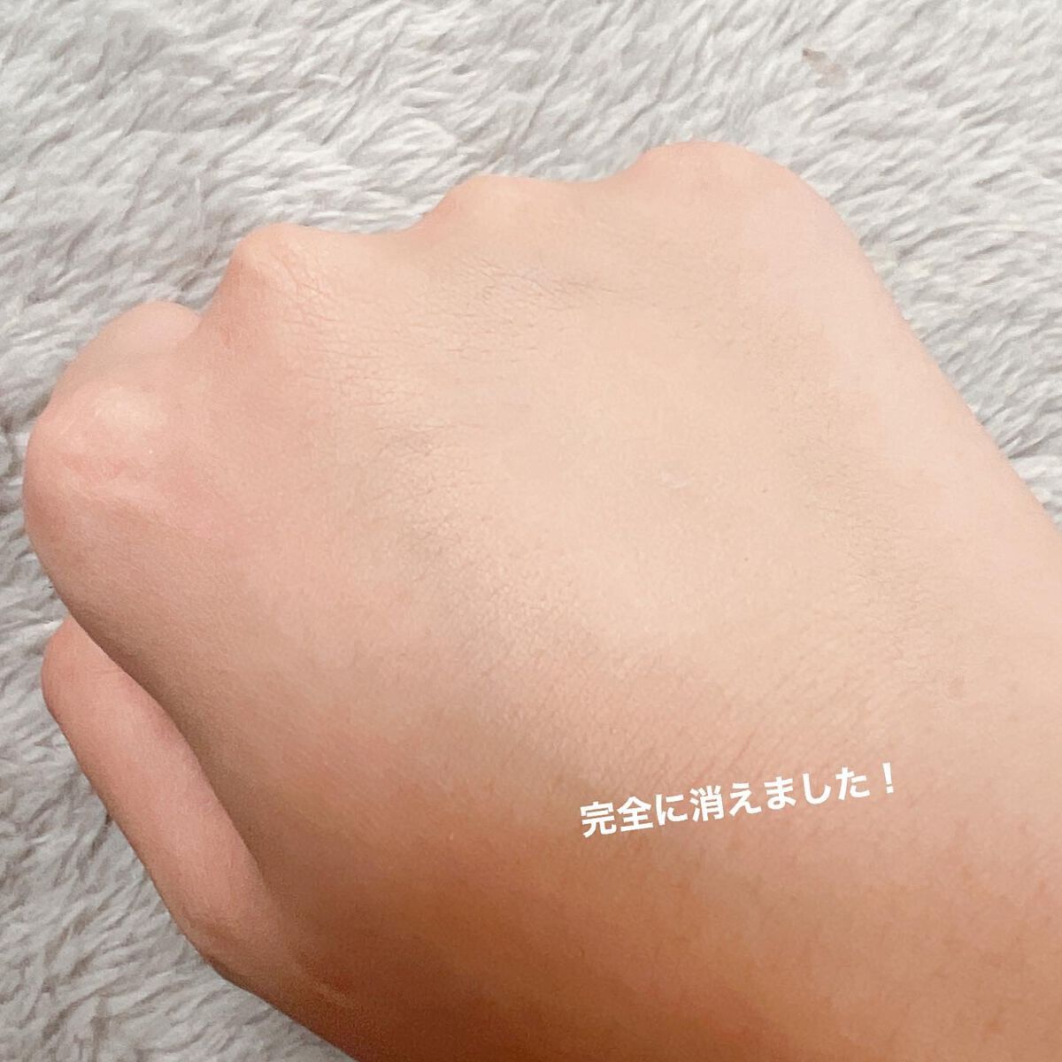 マーシュフィールド SC ボディカバーファンデN/マーシュ・フィールド/クリーム・エマルジョンファンデーションを使ったクチコミ(5枚目)