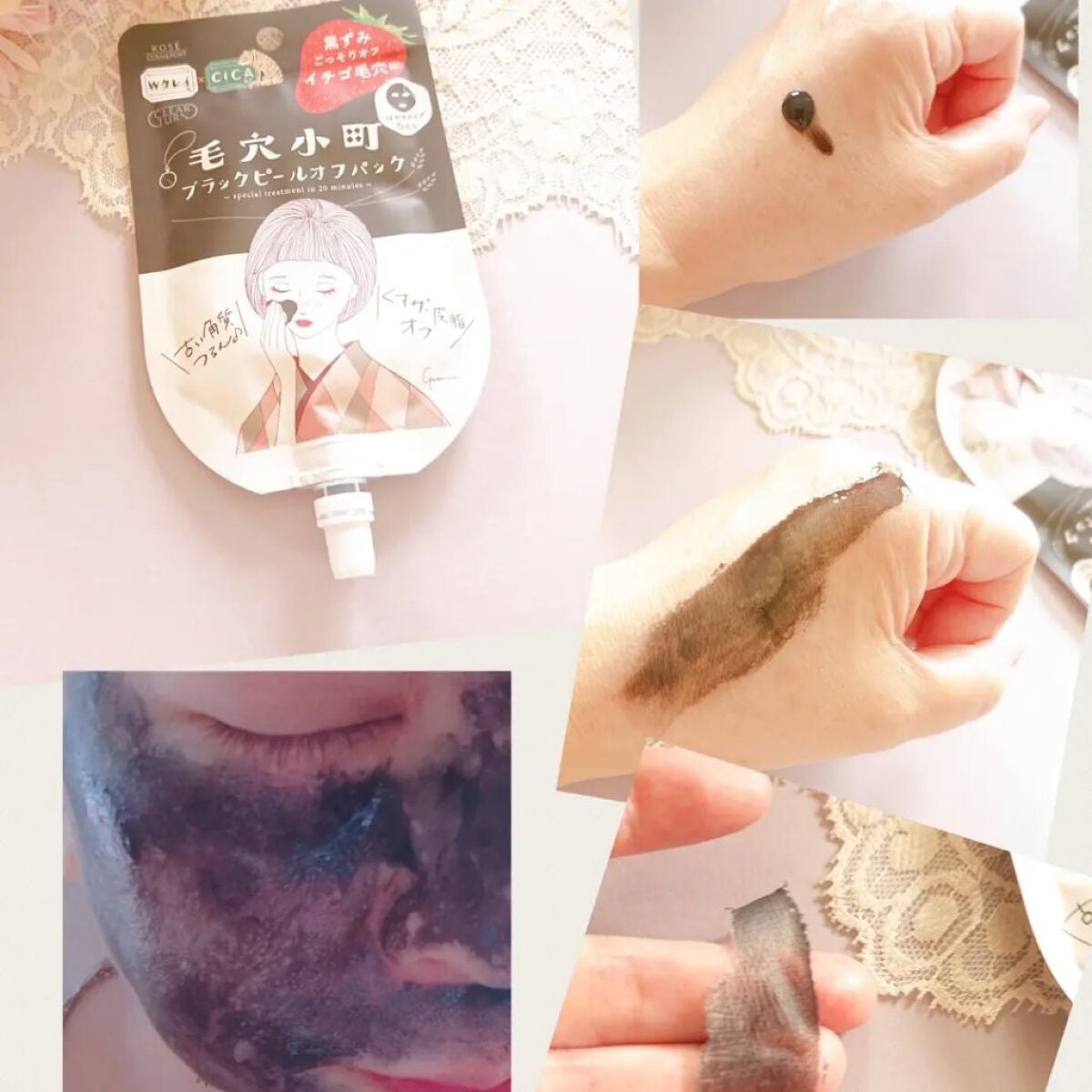 毛穴小町 ブラックピールオフパック/クリアターン/ピーリングを使ったクチコミ(3枚目)