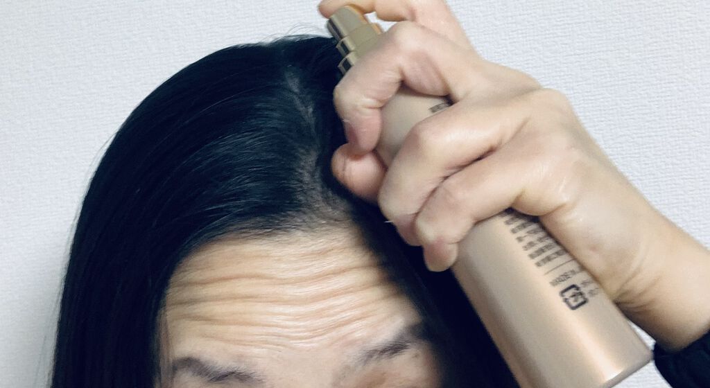 薬用スカルプエッセンス/HAIRICHE/頭皮ローションを使ったクチコミ（2枚目）