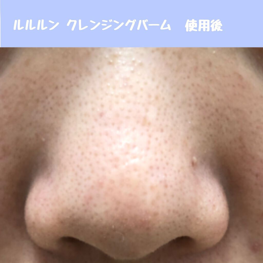 ルルルン クレンジングバーム(アロマタイプ)/ルルルン/クレンジングバームを使ったクチコミ(4枚目)