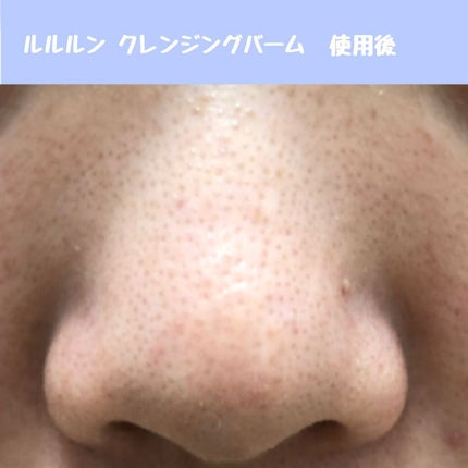 ルルルン クレンジングバーム(アロマタイプ)/ルルルン/クレンジングバームを使ったクチコミ(4枚目)