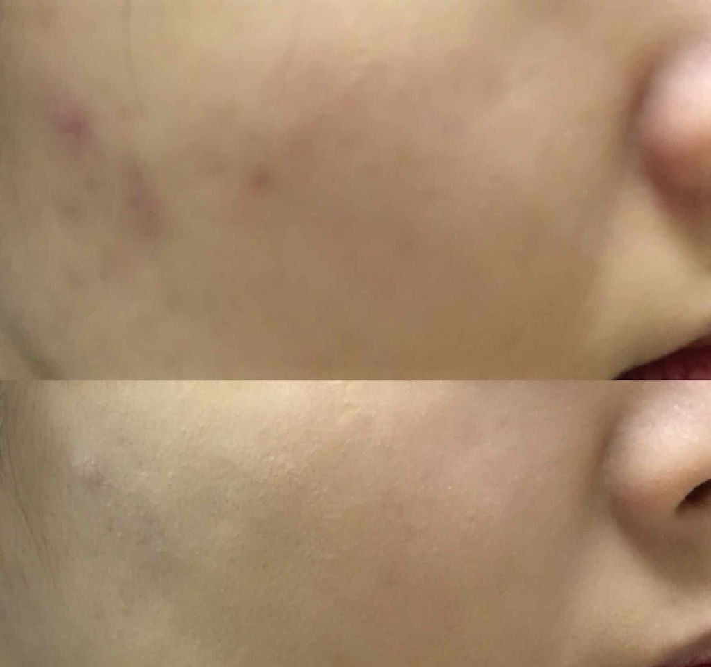 カバーパーフェクション チップコンシーラー/the SAEM/リキッドコンシーラーを使ったクチコミ(2枚目)