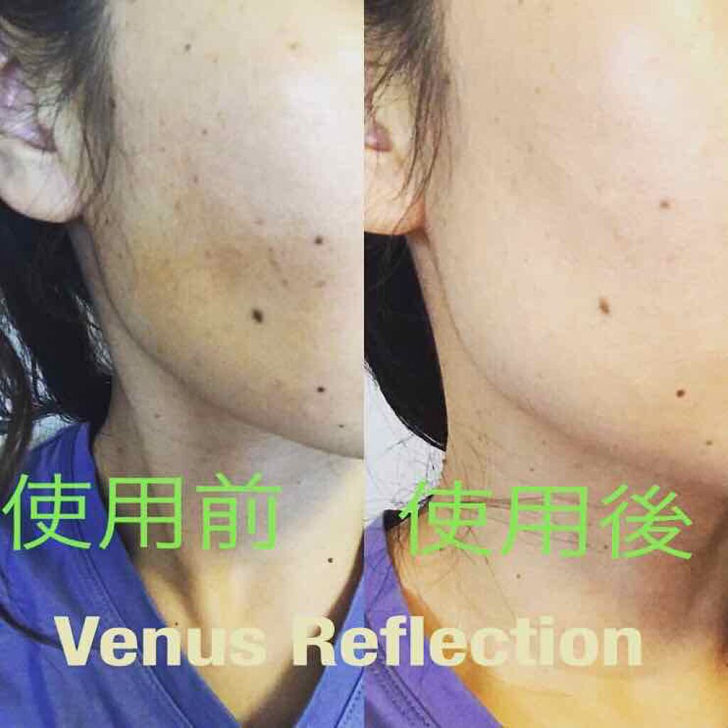 Venus Reflection/Venus SKIN/クリーム・エマルジョンファンデーションを使ったクチコミ(1枚目)