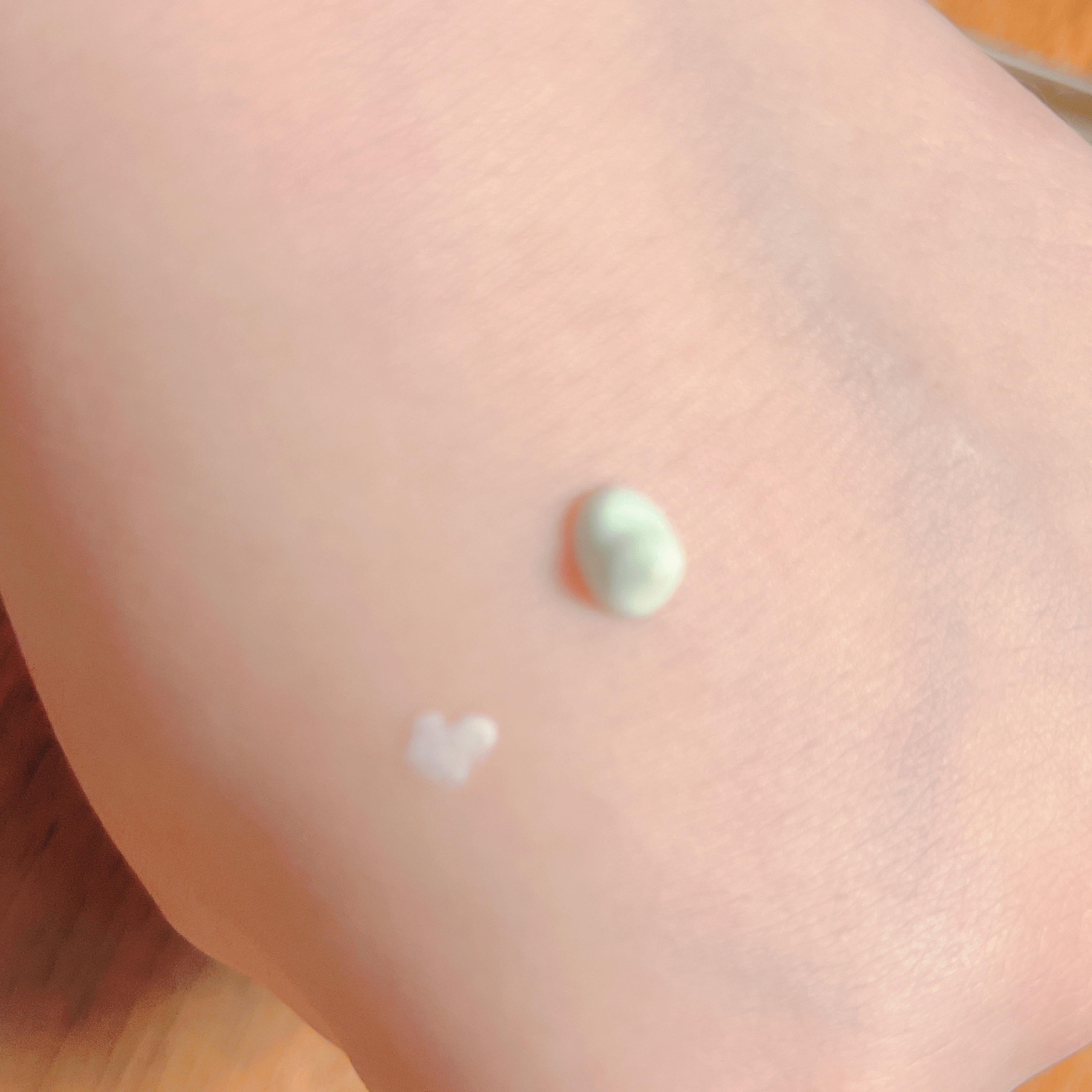 エーキュアショットスポットパッチ/obsero/にきびパッチを使ったクチコミ（2枚目）