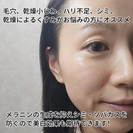 yukii on LIPS 「美容アイテム発信中♥️@kireijoshi_stylePER..」(5枚目)