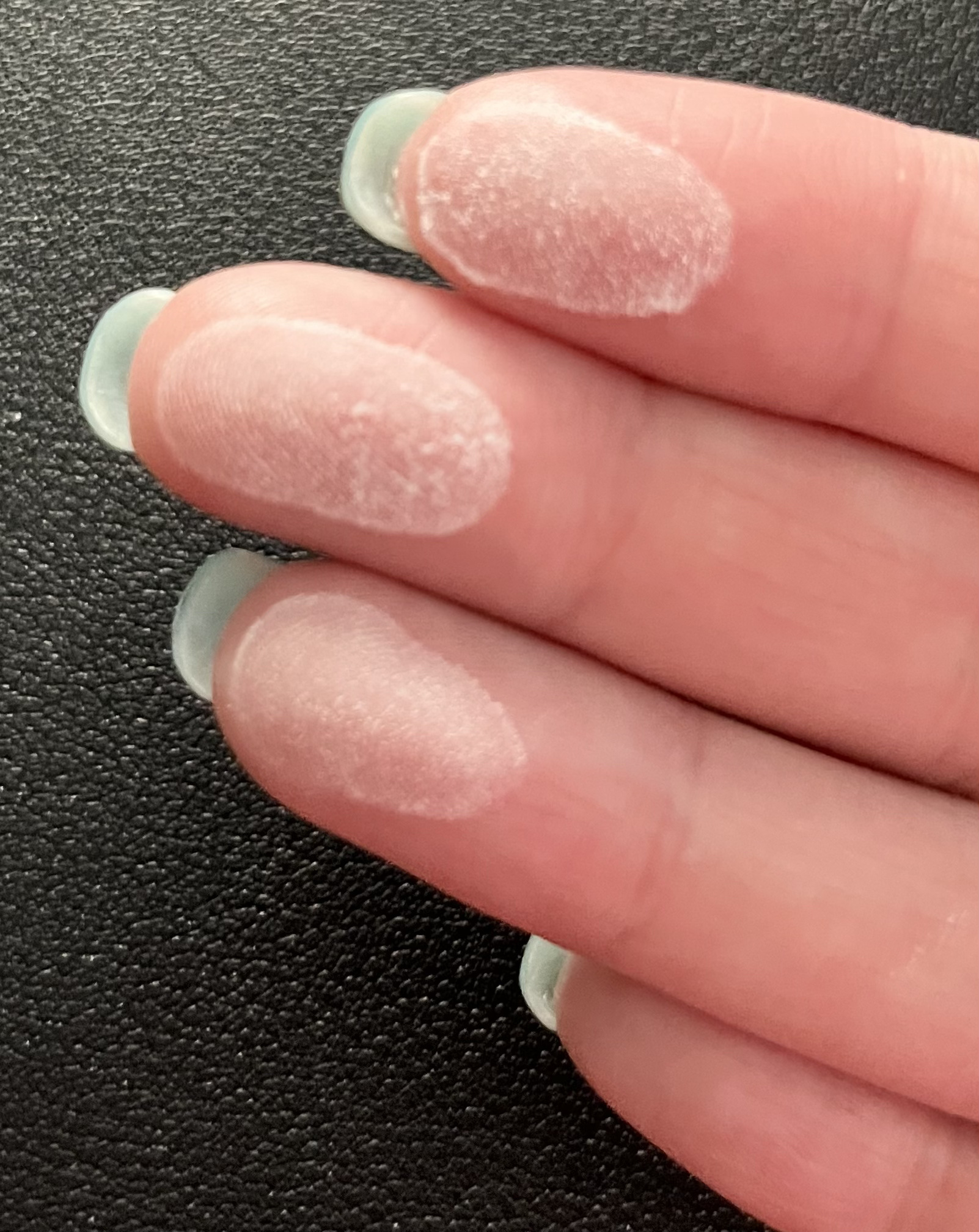 資生堂ベビーパウダー(プレスド)/ベビー/ボディパウダーを使ったクチコミ（3枚目）