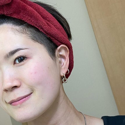 VC100エッセンスローション EX/ドクターシーラボⓇ/化粧水を使ったクチコミ(7枚目)