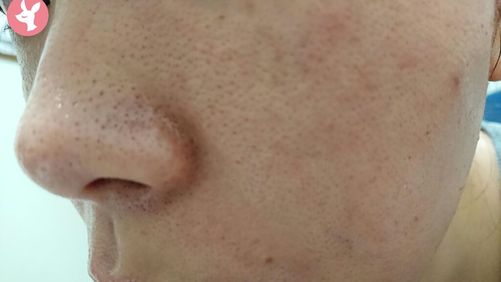 クレンジングバーム モイスト/CLAYGE/クレンジングバームを使ったクチコミ(1枚目)